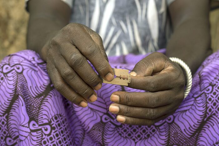 FGM - Female Genital Mutilation