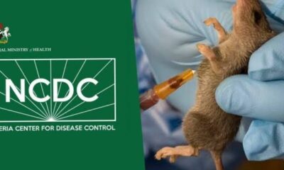 Lassa fever