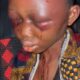 Lady beaten up on accusations of witch craft