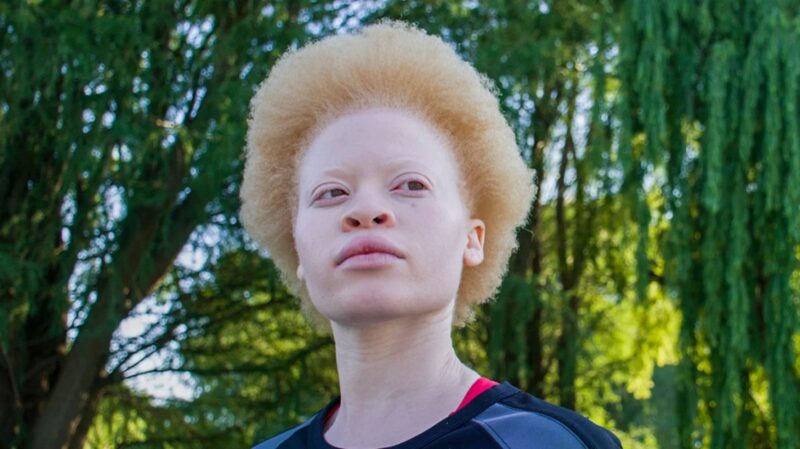 Albino