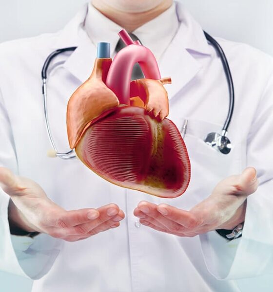 Ischemic Heart Disease